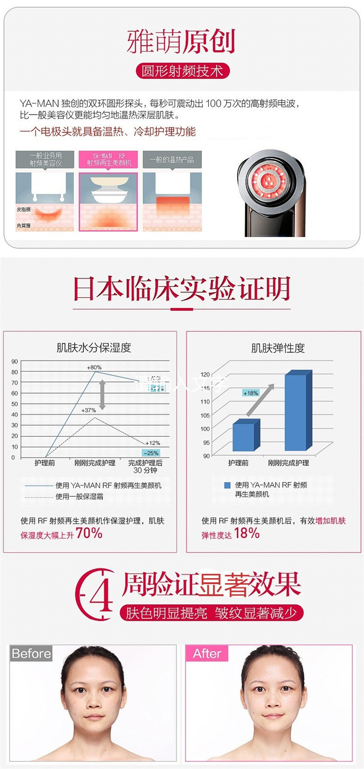 【爆款】【赵又廷同款】ya-man/雅萌日本美容仪器hrf-10t离子导入导出